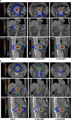 Investigate the Dosimetric and Potential Clinical Benefits Utilizing Stereotactic Body Radiation Therapy With Simultaneous Integrated Boost Technique for Locally Advanced Pancreatic Cancer: A Comparison Between Photon and Proton Beam Therapy